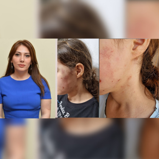 Lənkəran: icra başçısının müavini Rəsilə Əliyevanın məktəblini döydüyü iddia olunur