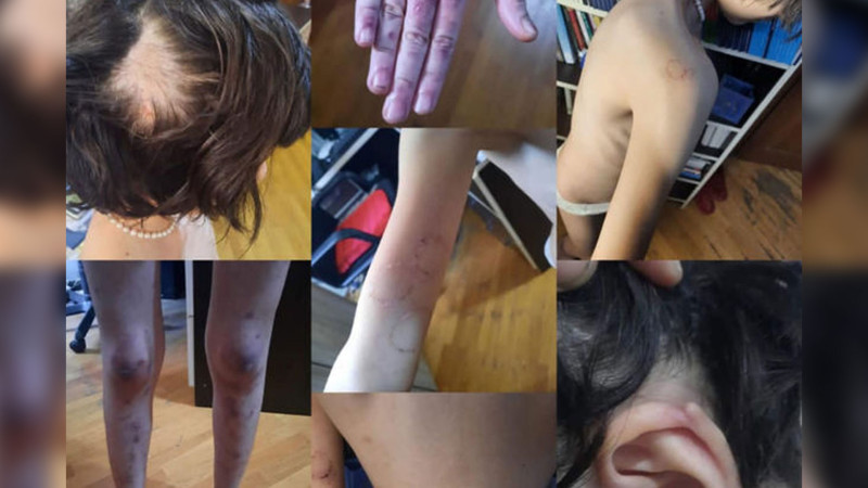 Masallıda hamilə qadın və 13 yaşlı yeniyetmə zorakılığa məruz qalıblar