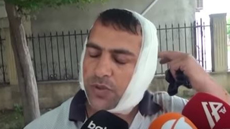 Uzunqulağın hücumuna məruz qalan Astara sakini hadisə haqqında danışıb
