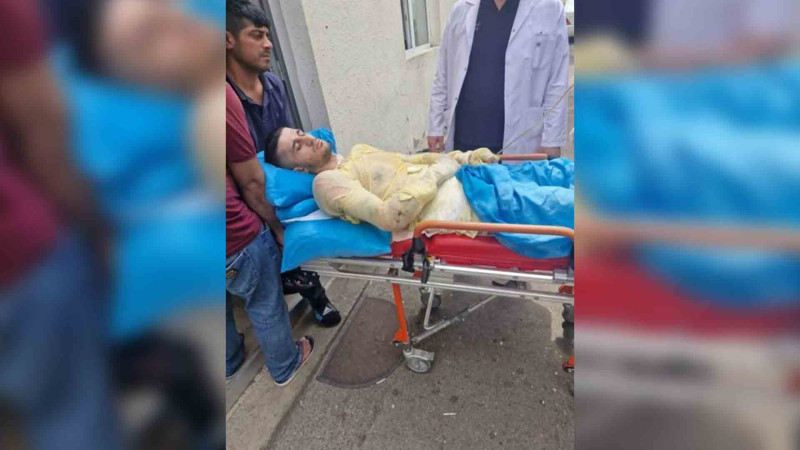 Cəlilabadda qazi qız qaçırdığı üçün özünü yandıraraq intihara cəhd edib