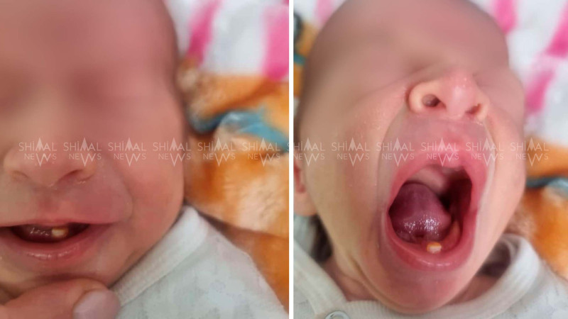 Azərbaycanda yeni doğulmuş körpə hamını təəccübləndirdi – FOTO