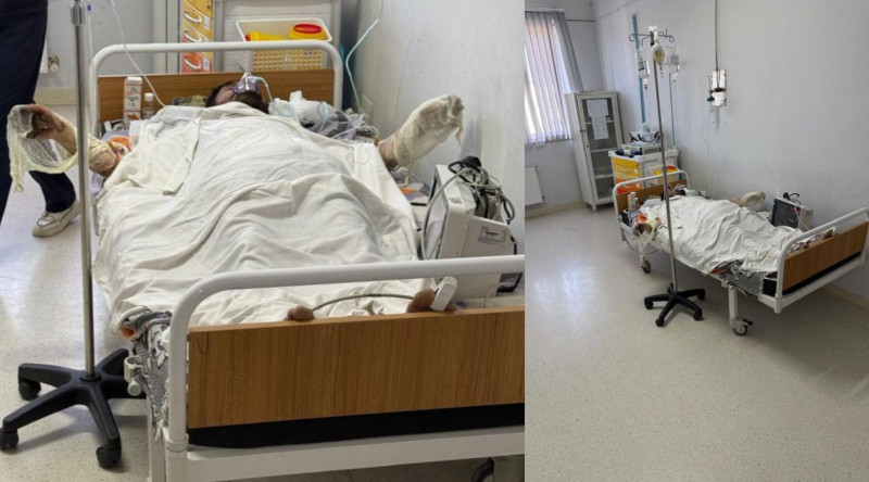 Masallı sakini sevdiyi qıza görə özünü yandırdı