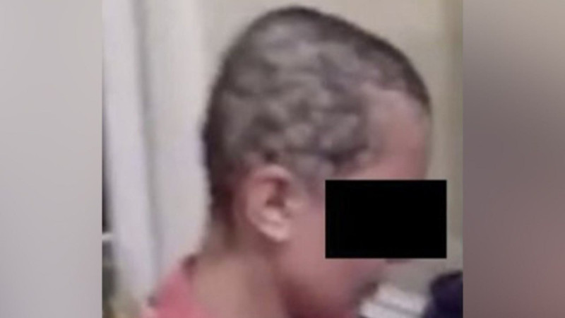 Masallıda sevgilisinin saçını qırxan kişi həbs edilib