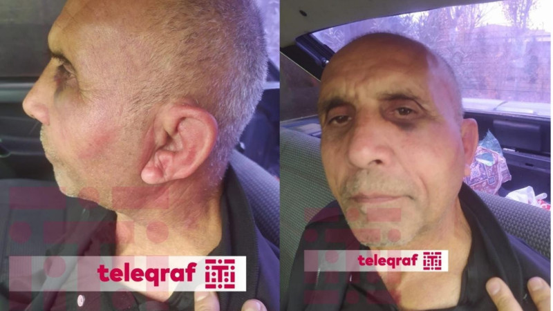 Masallı sakininin Psixiatriya Xəstəxanasında döyülməsi iddiasını polis araşdırır - RƏSMİ AÇIQLAMA