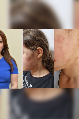 Lənkəran: icra başçısının müavini Rəsilə Əliyevanın məktəblini döydüyü iddia olunur