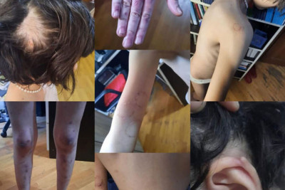 Masallıda hamilə qadın və 13 yaşlı yeniyetmə zorakılığa məruz qalıblar