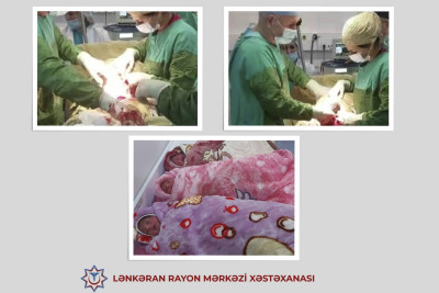 Lənkəranda üçəm dünyaya gəlib