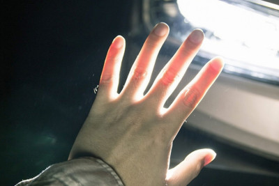 Lənkəranda qəza: piyada xəsarət alıb