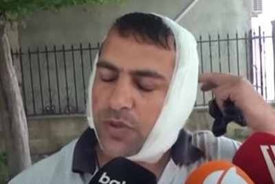 Uzunqulağın hücumuna məruz qalan Astara sakini hadisə haqqında danışıb