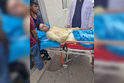 Cəlilabadda qazi qız qaçırdığı üçün özünü yandıraraq intihara cəhd edib