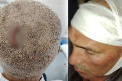 Yardımlıda kürəkən qayınatasının başına daşla vurdu