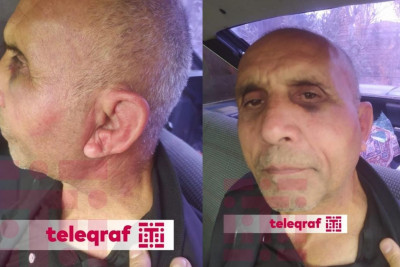 Masallı sakininin Psixiatriya Xəstəxanasında döyülməsi iddiasını polis araşdırır - RƏSMİ AÇIQLAMA